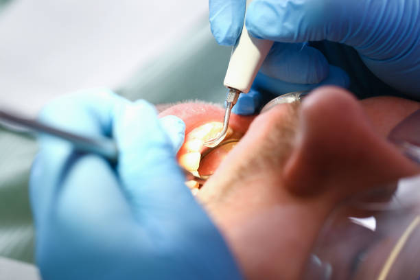 Best Same-Day Emergency Dental Services in Commerce, CA