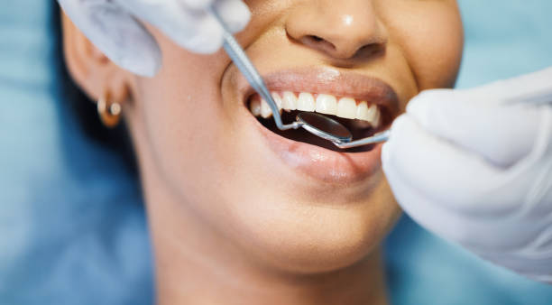 Best Emergency Treatment for Dental Infections or Abscesses in Commerce, CA